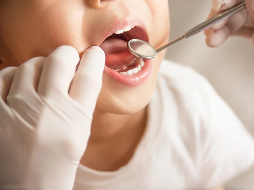 Examination of children's teeth