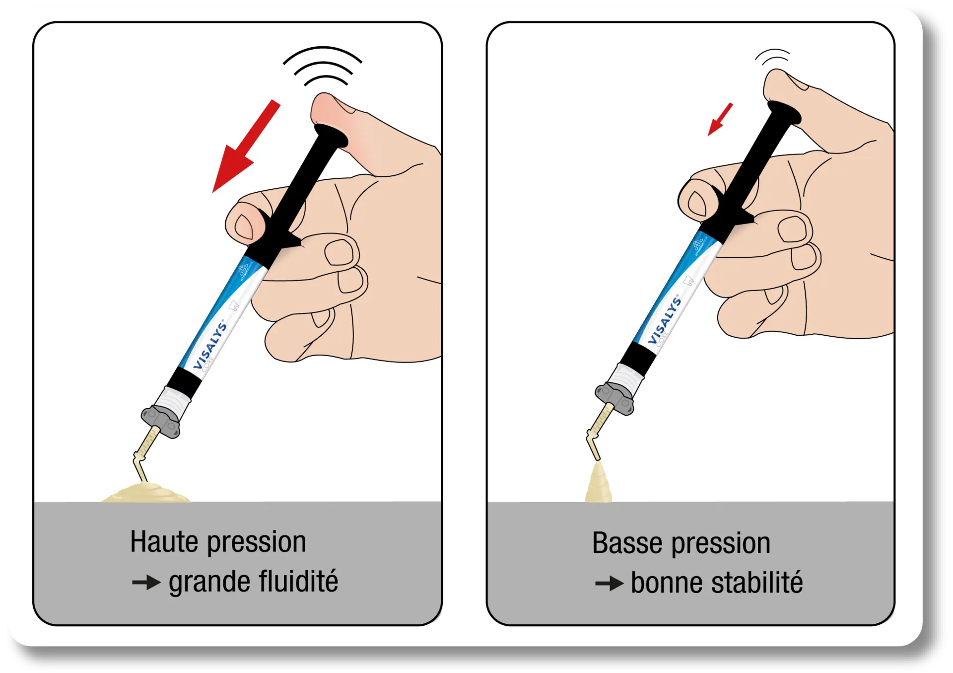 Pression d'application haute pour la fluidité, pression d'application basse pour la stabilité