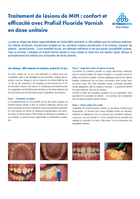 Traitement de l'hypersensibilité dentinaire : le vernis fluoré Profisil en dose unique allie confort et efficacité
