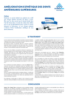Amélioration esthétique de la partie antérieure supérieure