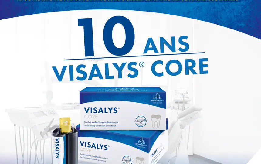 Résultats stables avec 10 ans de Visalys® Core. Reconstitution de moignon et scellement des tenon radiculaires.